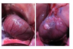 Hearts with and without adhesions