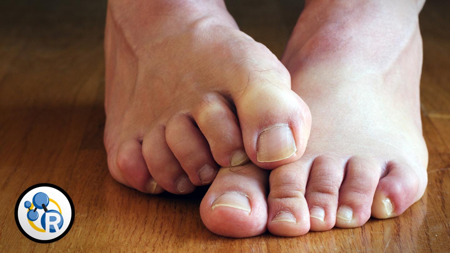 Why Do Feet Stink? (Video)