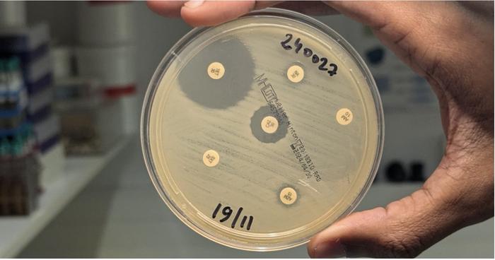 Antibiotic susceptibility of the Vibrio cholerae strain responsible for the 2024 outbreak in Mayotte. © Vibrios and Cholera CNR - Institut Pasteur