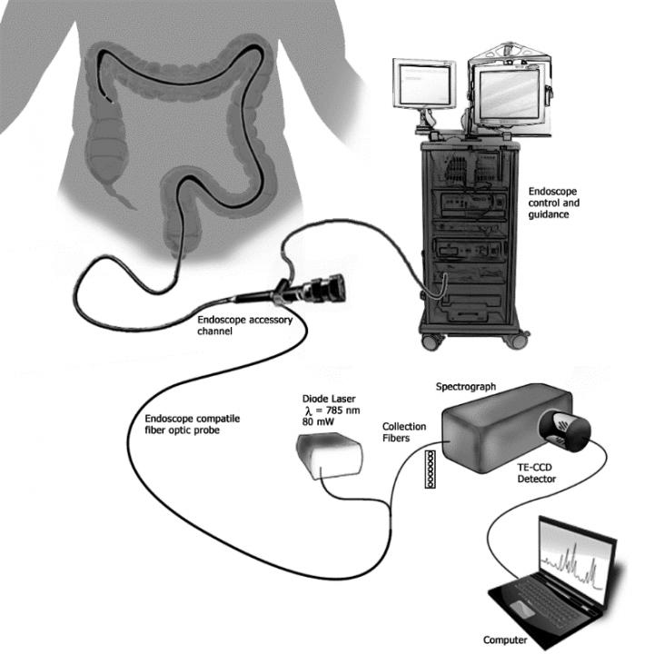 Schematic of IBD Endoscope