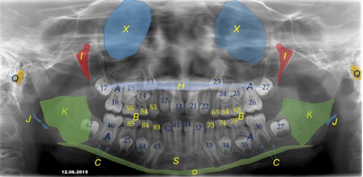 Oral And Maxillofacial Radiology Anatomy