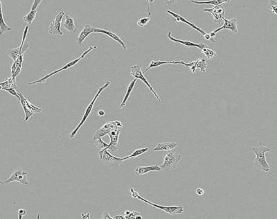 Vestibular Schwannoma Cells Treated with Mifepristone