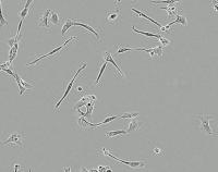 Vestibular Schwannoma Cells Treated with Mifepristone