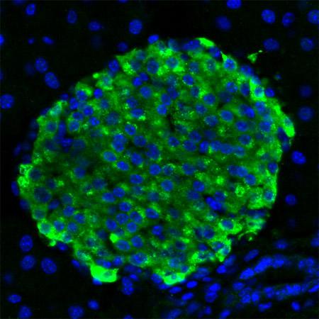 Pancreatic Beta Cells, UC San Diego School of Medicine