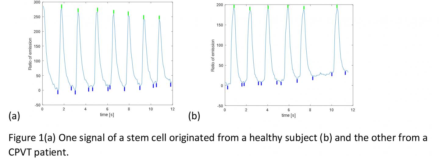Figure 1(A) One Signal of a Stem Cell Originated From a Healthy Subject (B) and the Other From a Cpv