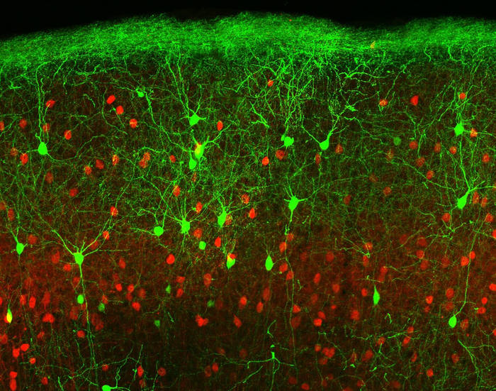 Nerve cells (in red and green)