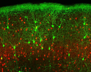 Nerve cells (in red and green)