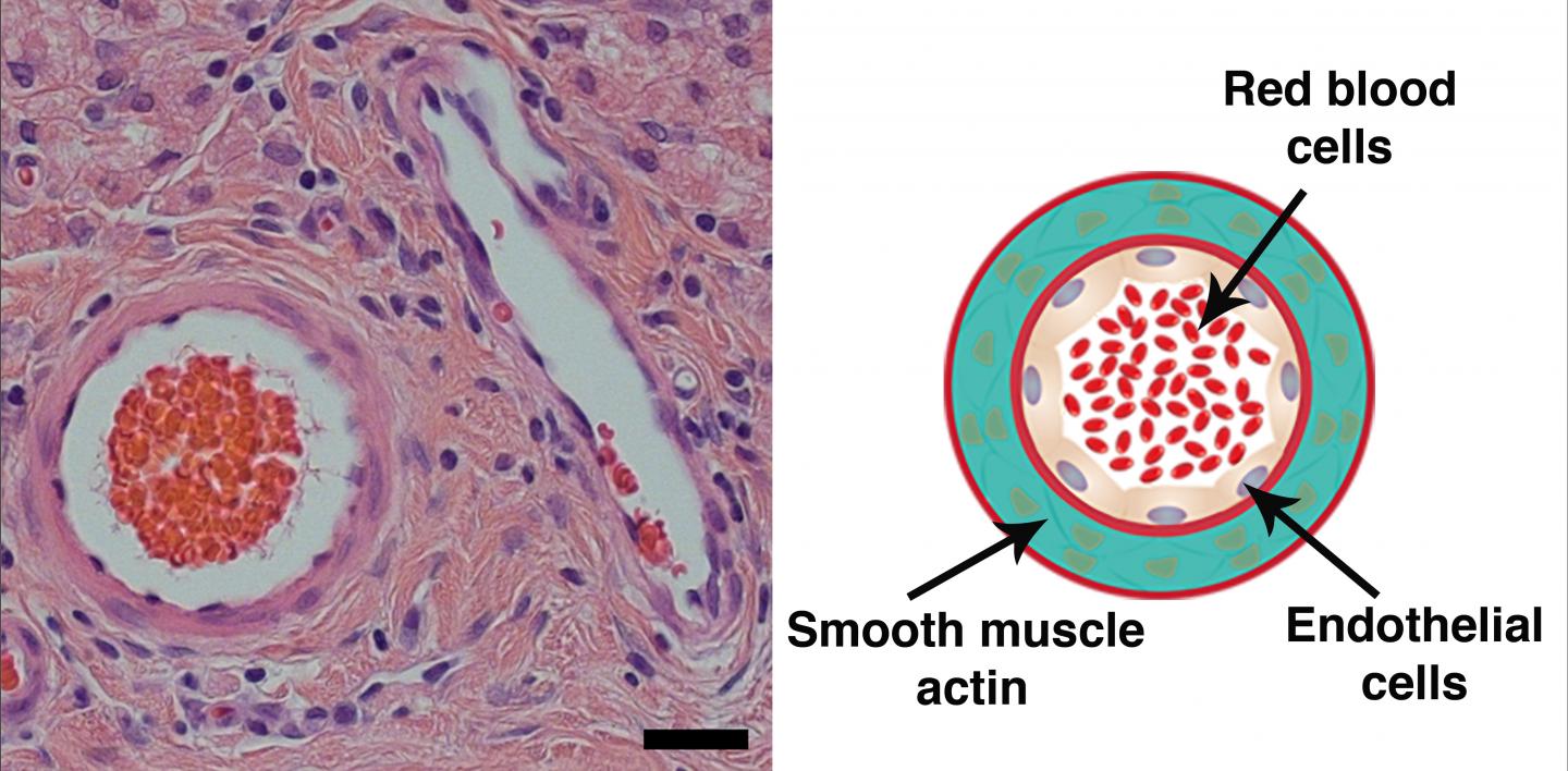 Hydrogel Spurs Growth