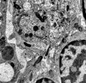 Ribbon-like Golgis in epidermal cells