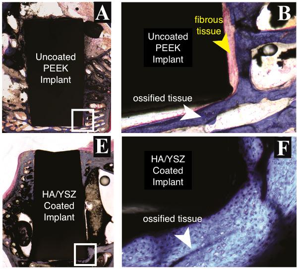 Bioactive Film Improves How Implants Bond With Bone