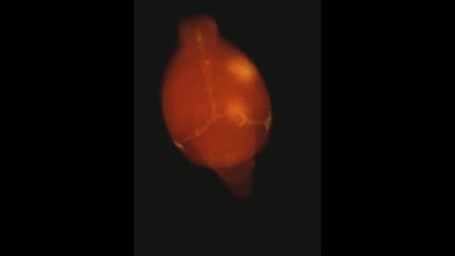 Video of Focused Ultrasound-Induced Blood-Brain Barrier Openings in a Mouse Brain