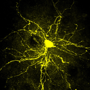 Medium Spiny Neuron located in the nucleus accumbens, one of the neural networks of the reward system.