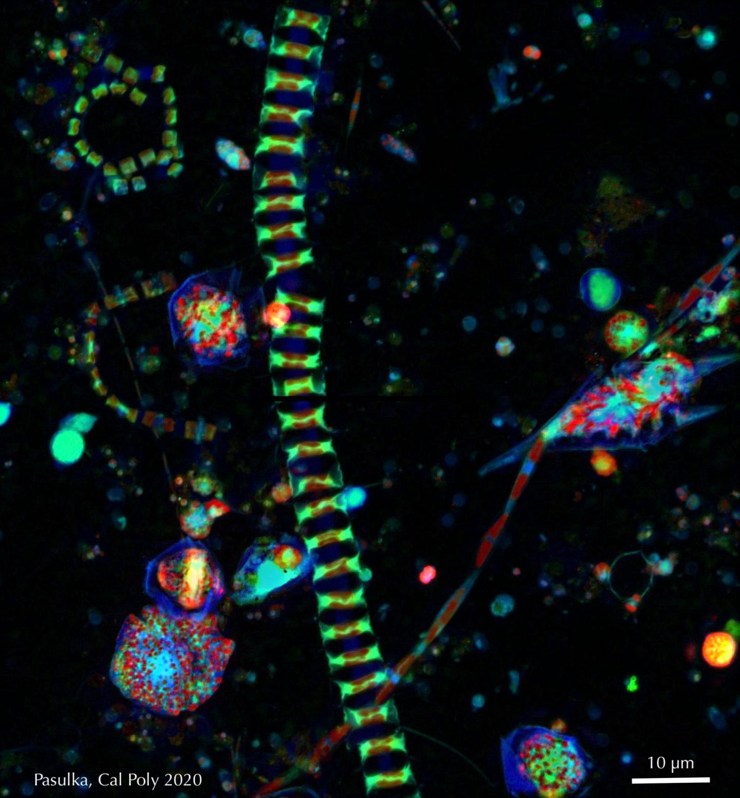 Fluorescence microscopy image of phytoplankton with chain-forming diatoms and large dinoflagellates