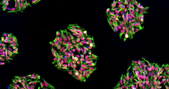 Colonies of Neural Progenitor Cells