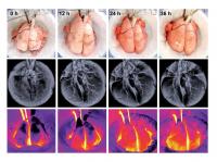Photographic, Radiographic And Thermographic Images Of Injured Lungs Recovered With Extracorporeal C