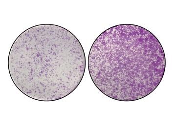 The Effect of Losing the TYW2 Gene and the "Y" Nucleotide in Colon Cancer