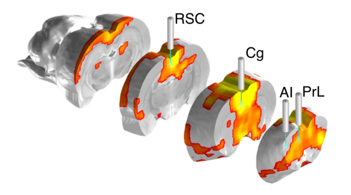 fMRI and optical fiber photometry
