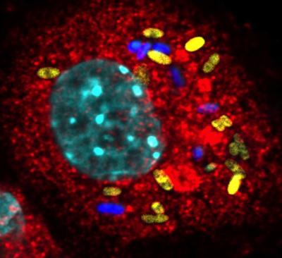 Infection of An Immune Cell with <i>E. coli</i>