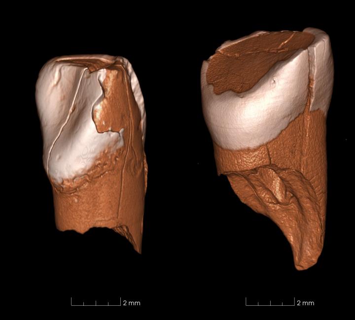 Ancient Teeth Inform Humans' Arrival in Europe (5 of 8)