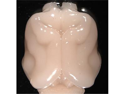 Figure 1: A View of the Ferret Brain
