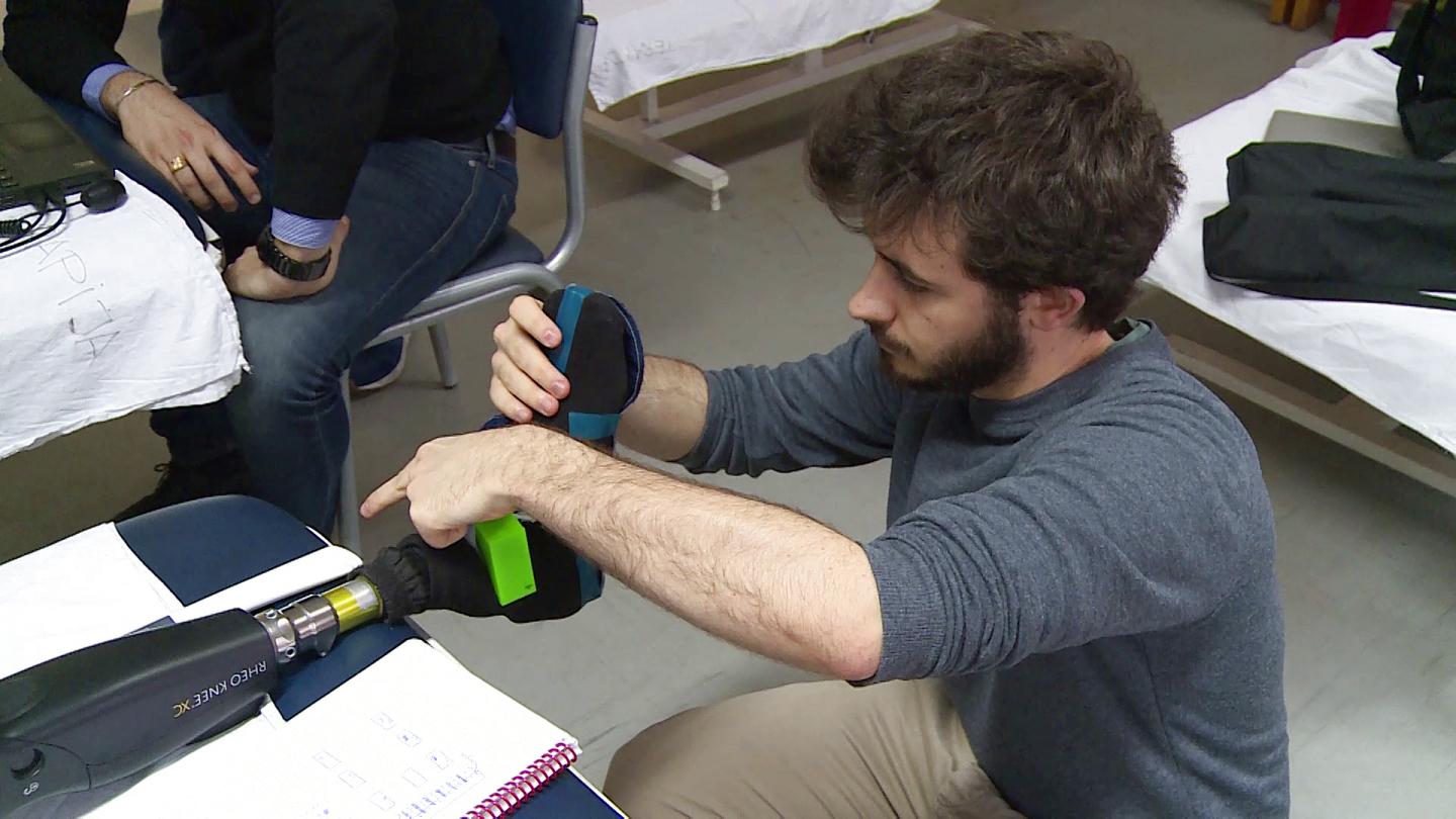 Nerve-Stimulating Leg Prosthesis Improves Movement and Functionality in Amputees (6 of 10)