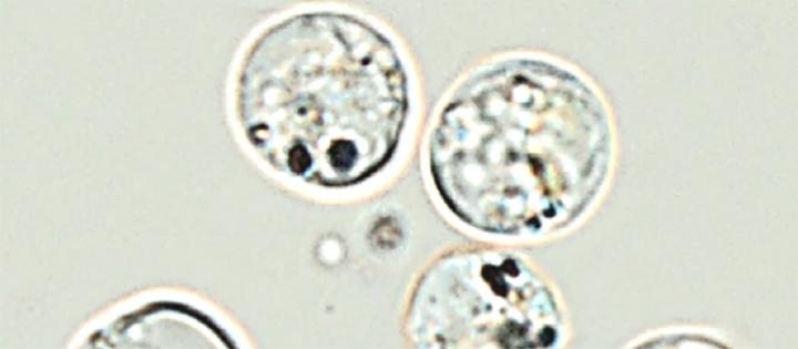 Optical microscopy image of nanoAg uptake by golden-brown alga Poterioochromonas malhamensis.