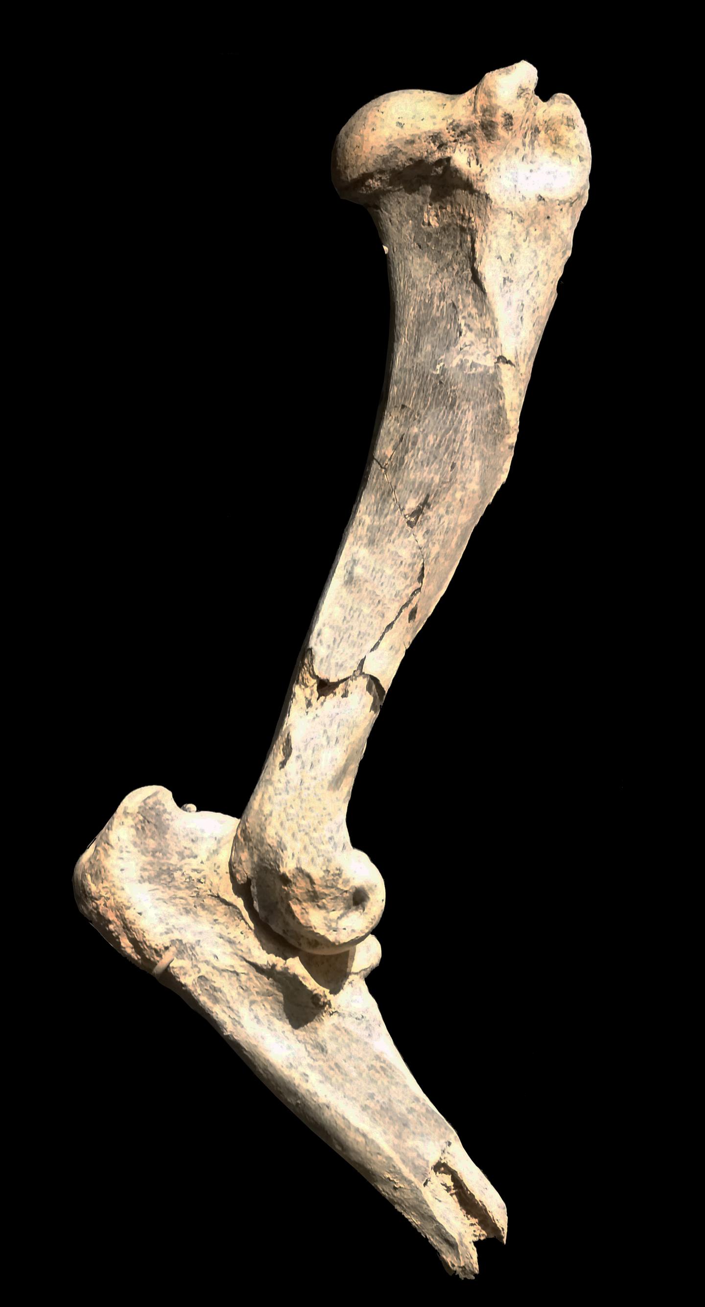 Humerus bone