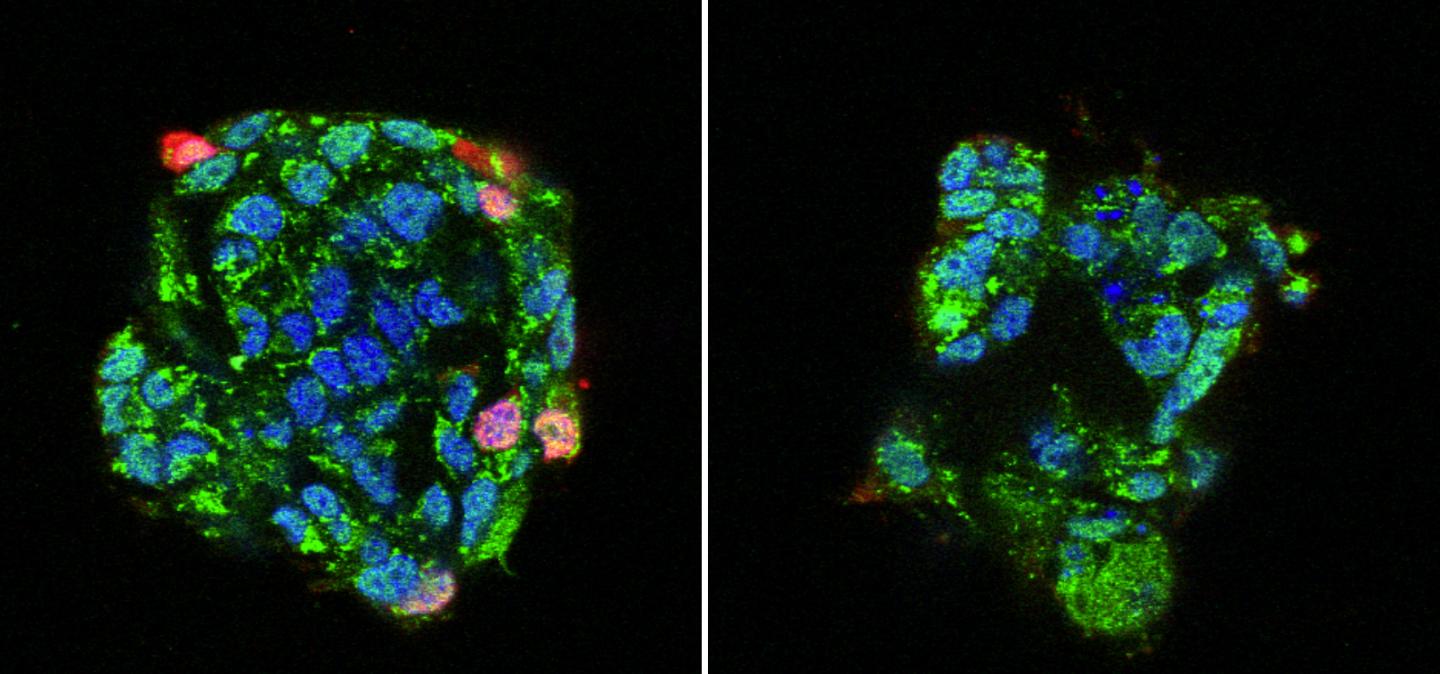 IAV Infected and Suppressed Human Cells