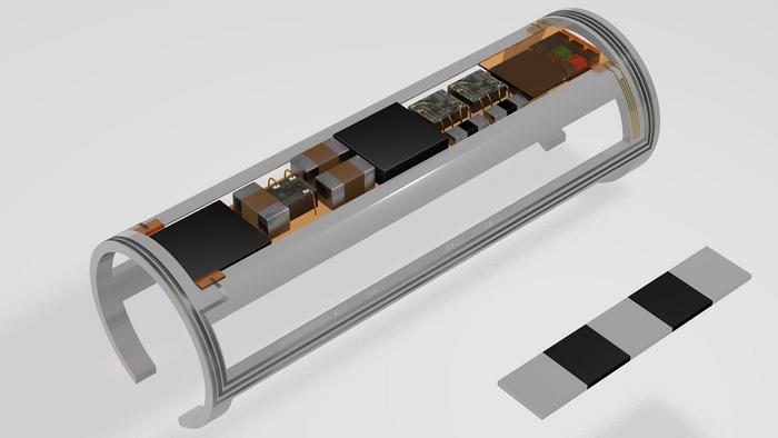 A miniaturized, implantable multi-sensors device to monitor vessels health