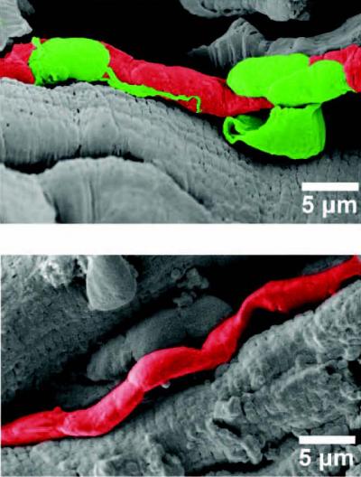 Loss of Blood Vessel Cells Linked to Heart Damage