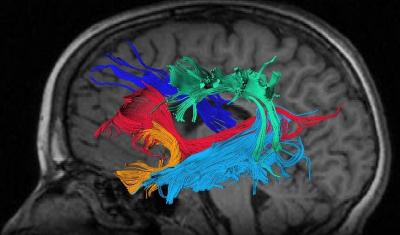 White Matter Tracts