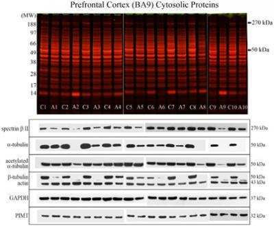 Protein Profiles of the Prefrontal Cortex