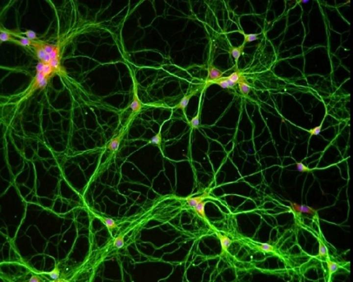 Mouse Neurons in Hippocampus