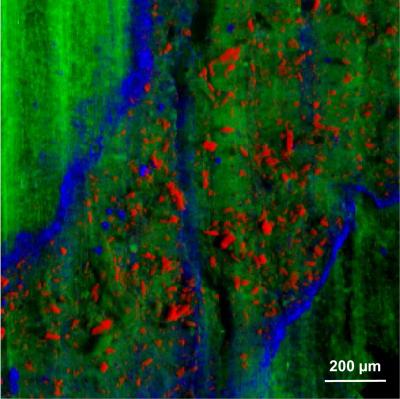 X-ray fluorescence maps