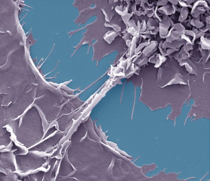Nanotubes Linking two Macrophages