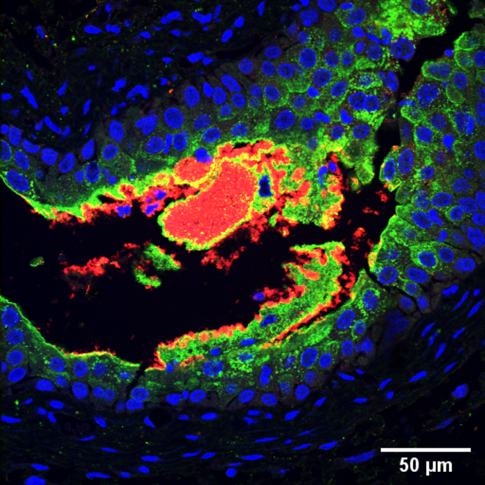 E. coli infecting mouse bladder