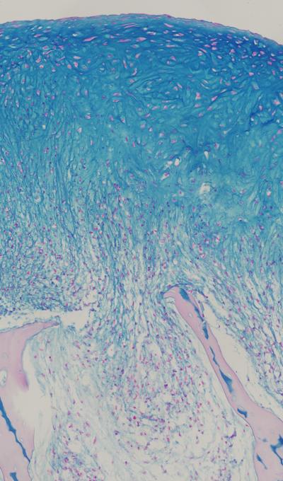 Columbia Engineers Grow Functional Human Cartilage in Lab