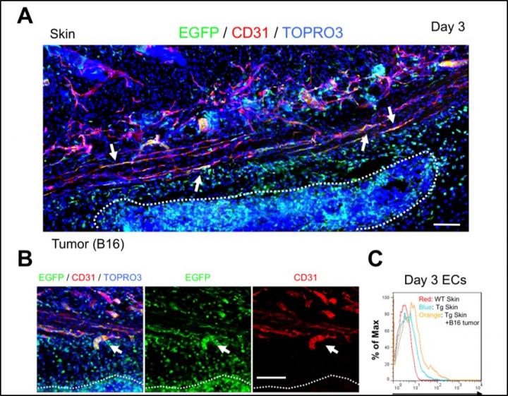 Biomarker Helps Identify 'Window of Opportunity' for Cancer Chemotherapy Timing