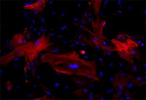 Perivascular fibroblasts observed in the study