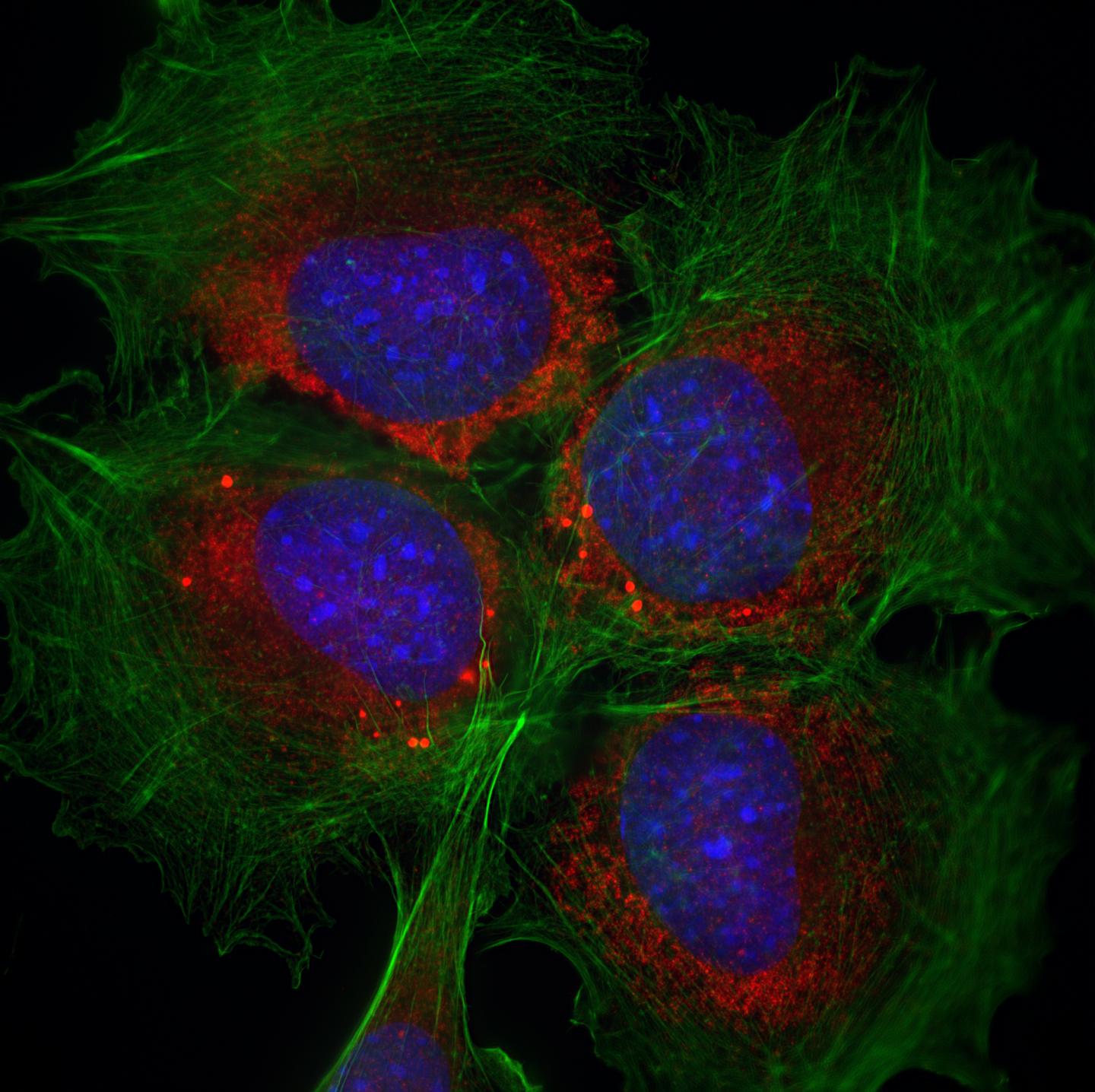 Cells that Lack the Protein PERK Observed under a Fluorescence Microscope