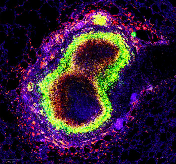 TB Granuloma Multiplexed Image