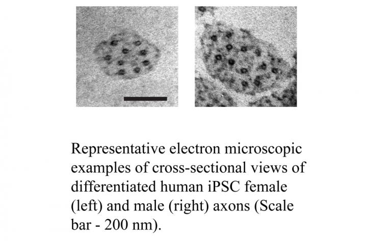 Women May be More Vulnerable to Concussions Because of "Leaner" Nerve Fibers, Penn Study Suggests