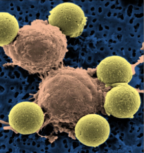 Scanning electron microscopy of anti-CD3/28 beads (yellow) stimulating CAR T cells (orange).