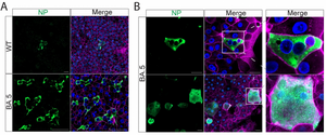 Nasal organoids