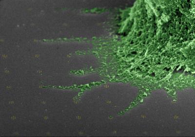 False Color Scanning Electron Micrograph of a T Cell
