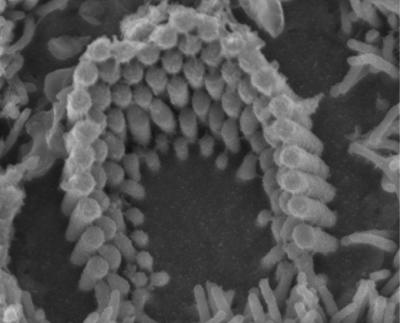 Hair Cell Transduction Channel