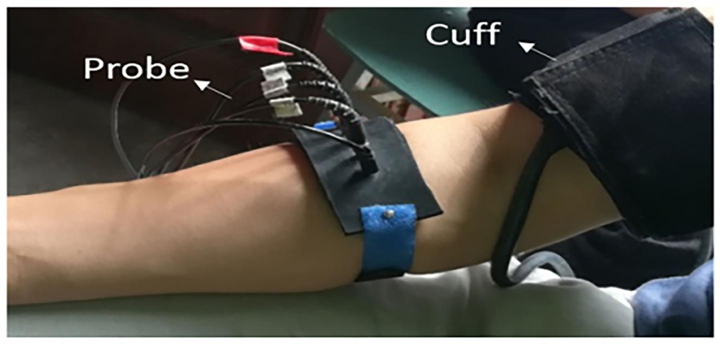 Blood Circulation of the Forearm Obstructed by Arm Cuff