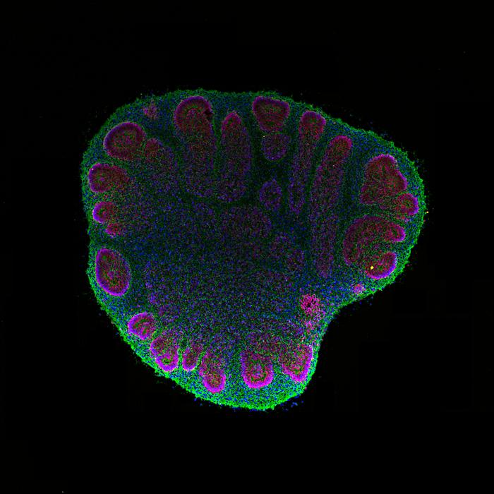 Cross-section of a two-month-old cerebral organoid observed under a fluorescence microscope