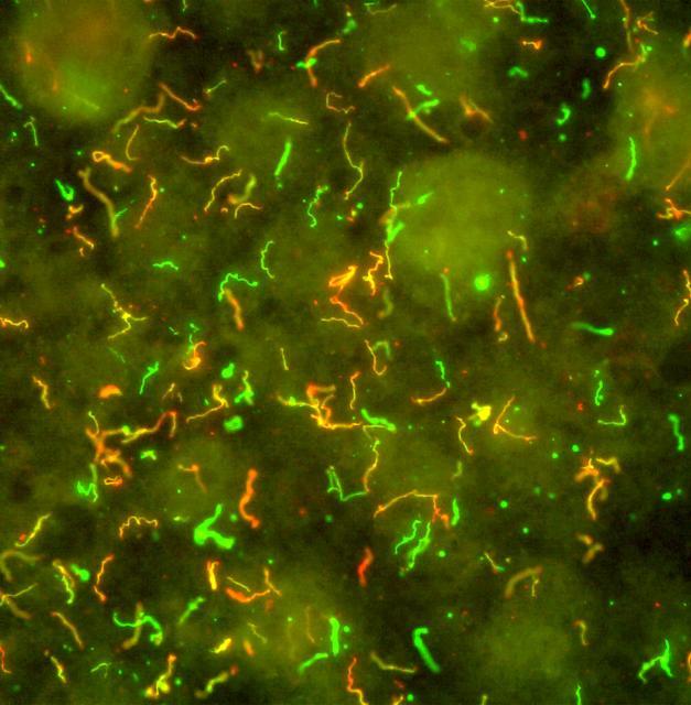 Spiral-Shaped <em>Borrelia Burgdorferi</em> Bacteria