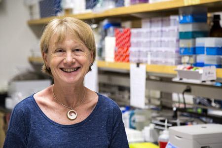 Jane Burns, UC San Diego School of Medicine